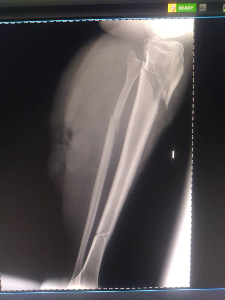 Emergency Surgery: Help Us Heal a Life đ! đ©čâ€ïž