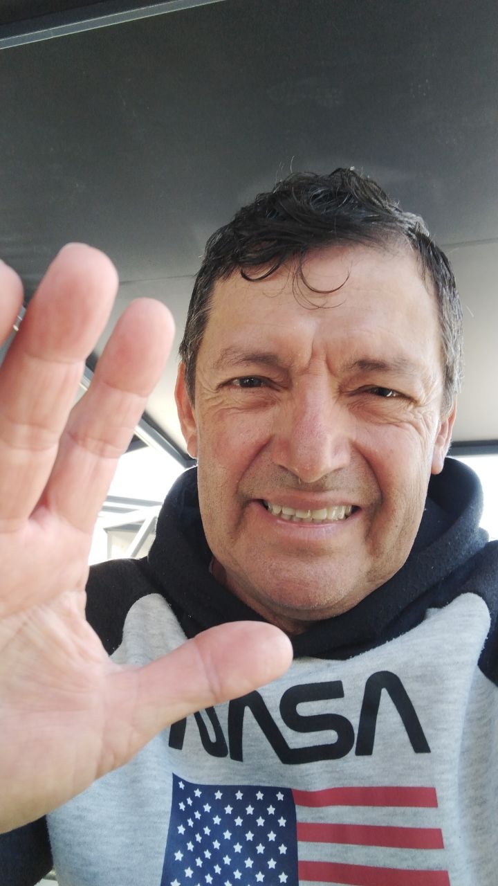 Apóyame a recuperar la vista de mi ojo izquierdo